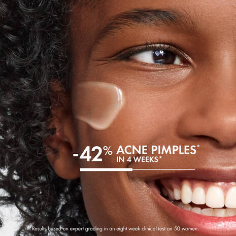 Vichy Normaderm Phytoaction Acne Control Moisturizer 50ml (Packaging may vary) - Image 4