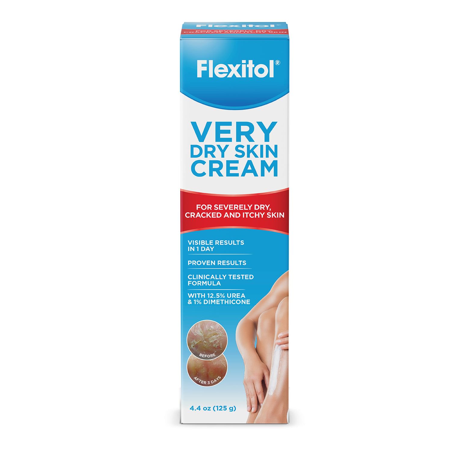 Flexitol Very Dry Skin Cream, Rich Moisturizing Body Cream with Urea, 4.4 Oz