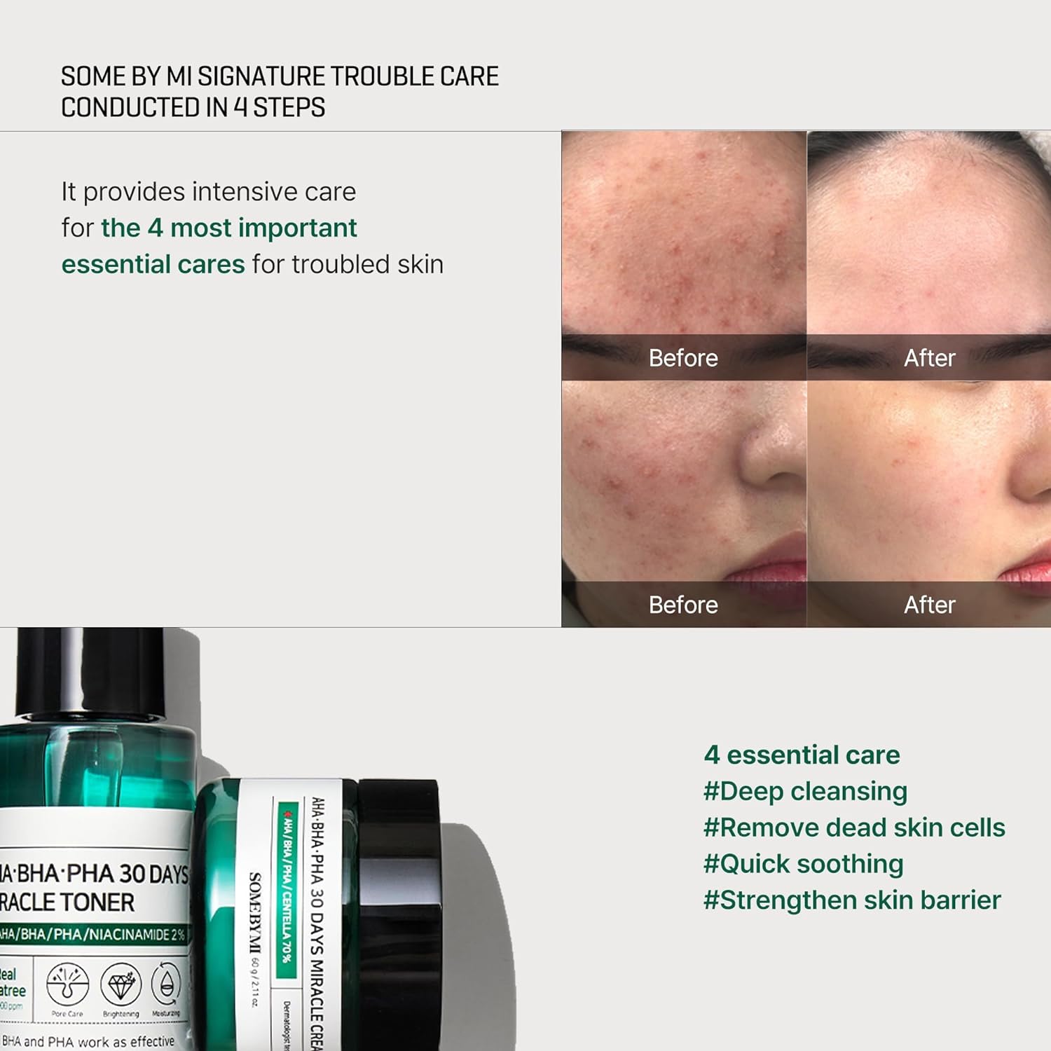 SOME BY MI AHA BHA PHA 30Days Starter Kit - Toner 1.01Oz, Serum 0.33Oz, Cream 0.7Oz, Cleansing Bar 1.05Oz - Image 3