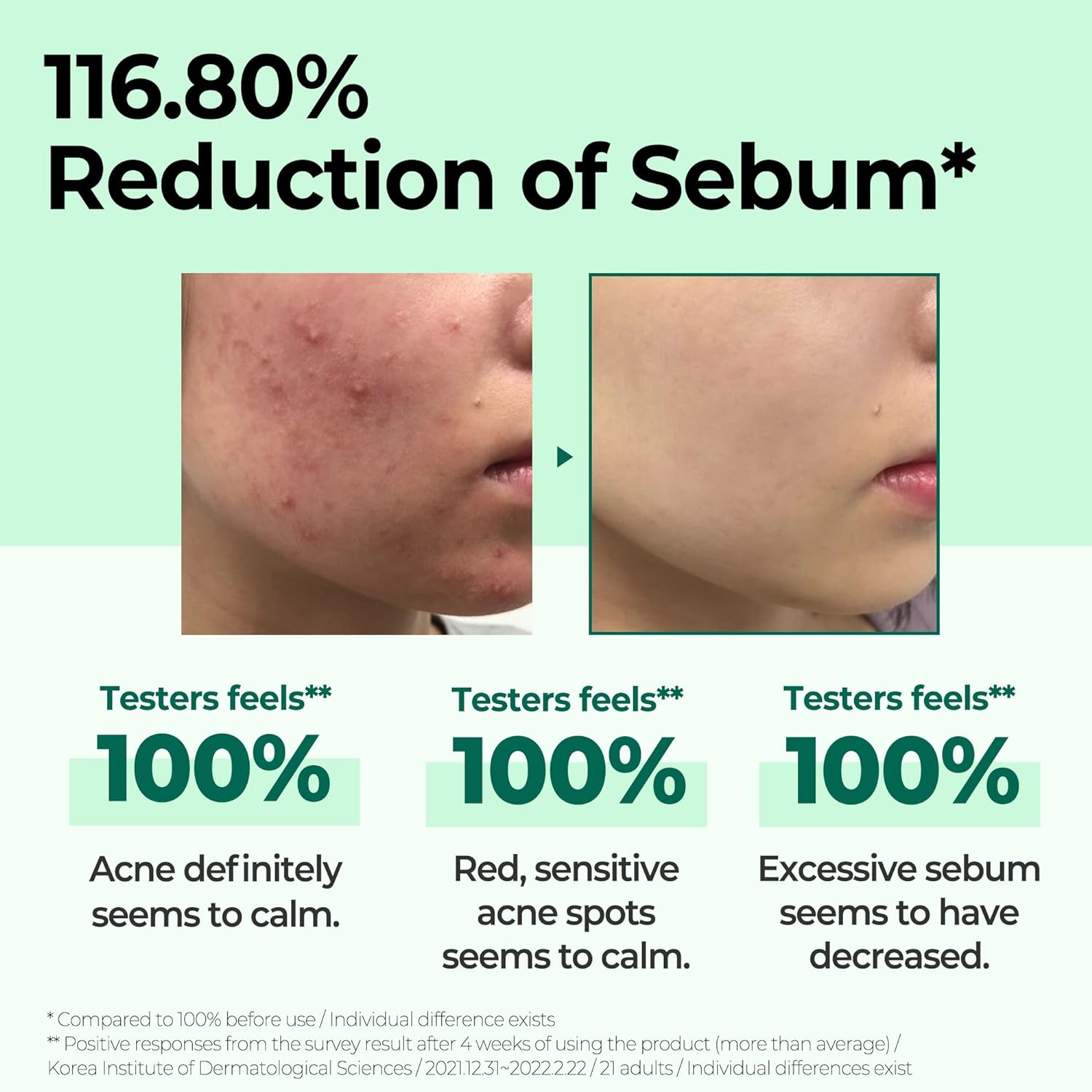 SOME BY MI AHA BHA PHA 30 Days Miracle Toner - 5.07Oz, 150ml - Image 5