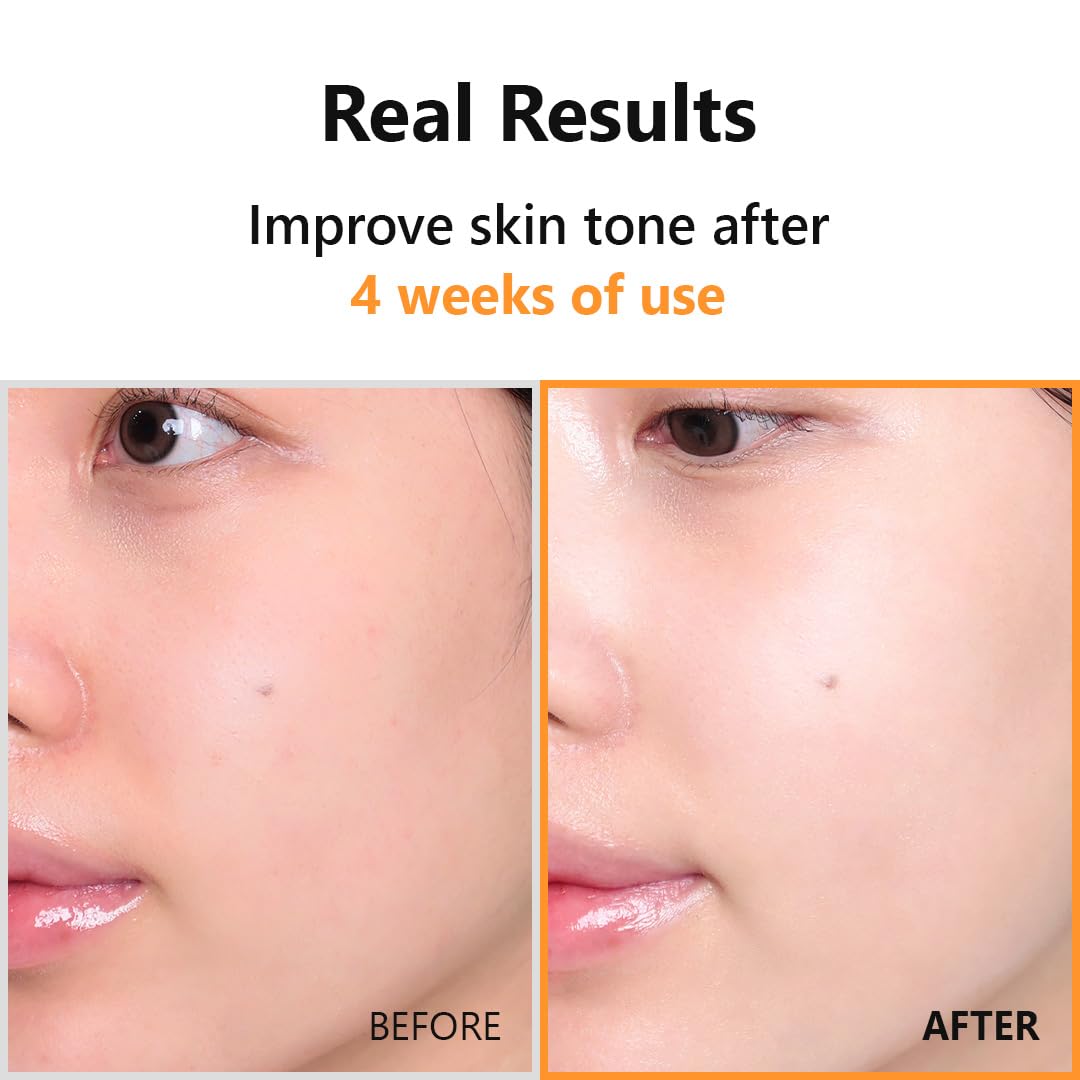 ISNTREE Hyper Vitamin C 23 Serum 20ml | Vitamin E | Panthenol | Even Skin Tone - Image 5