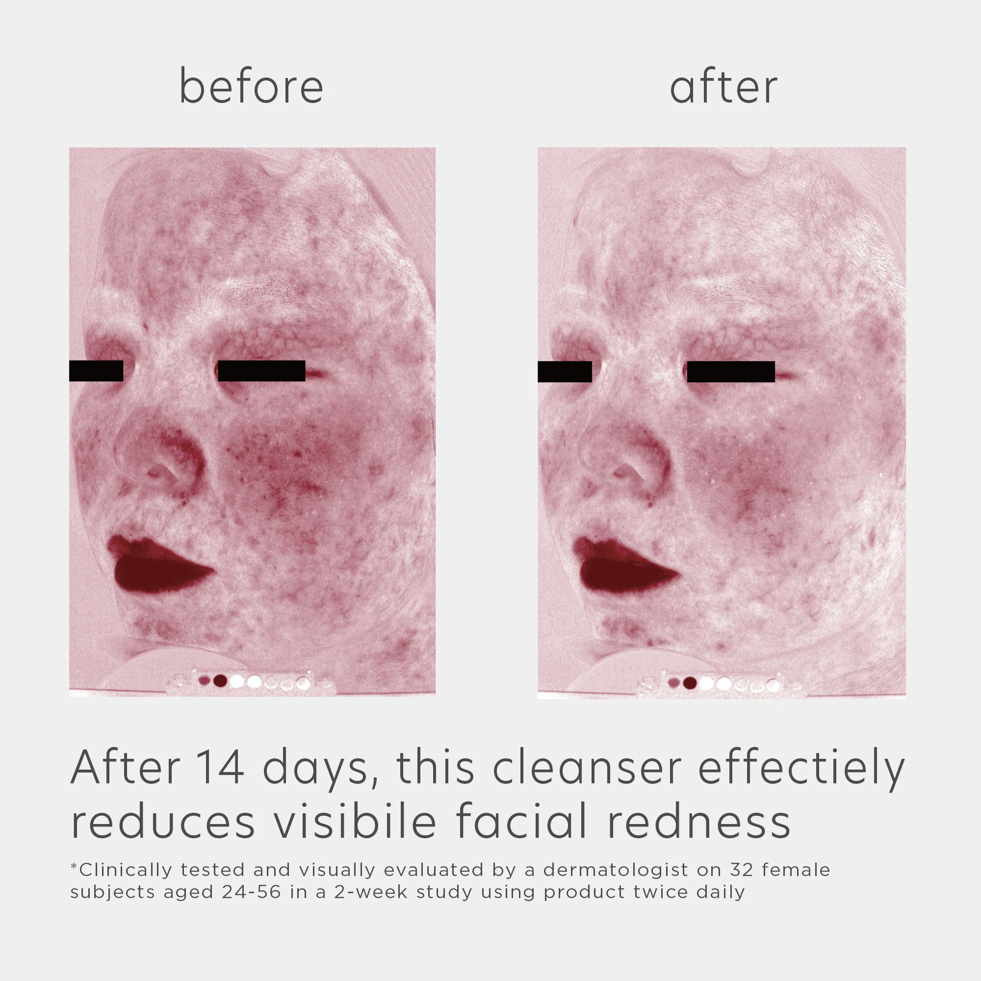 EltaMD Skin Recovery Amino Acid Foaming Cleanser 5oz - Image 7