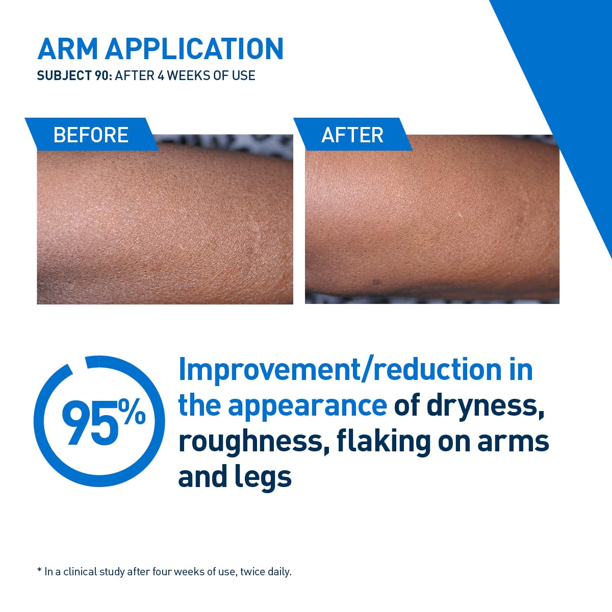 CeraVe Intensive Moisturizing Lotion - 16 fl oz -VALUE SIZE - Image 8