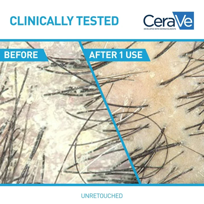 CeraVe Hydrating Anti-Dandruff Shampoo, Fragrance Paraben & Sulfate Free, All Hair Types, 12 fl oz - Image 4