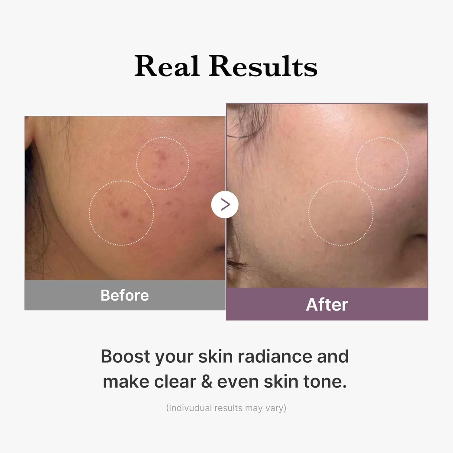 Medicube Age-R Glutathione Glow Toner 140ml - Image 8