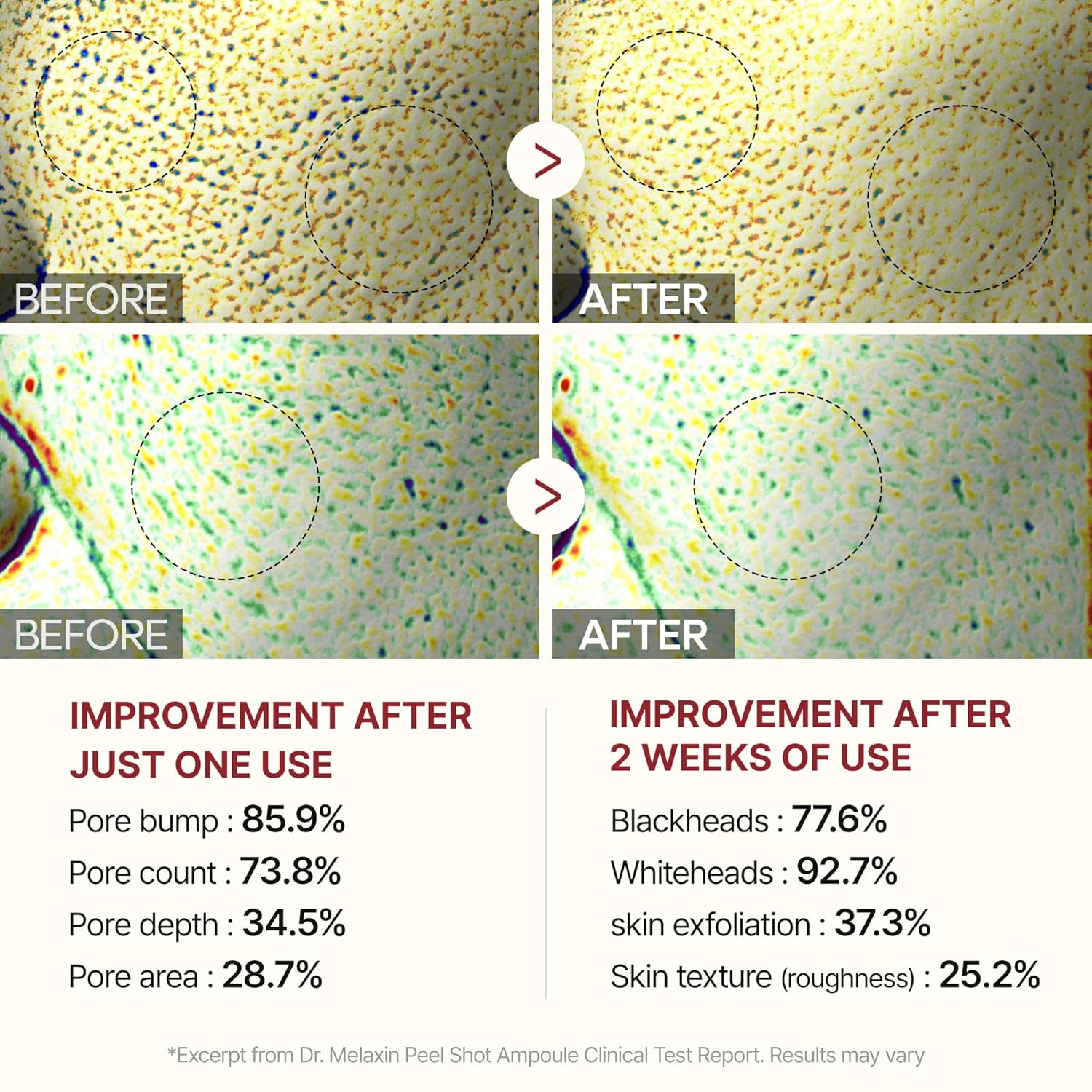 Dr Melaxin Peel Shot Glow White Rice Peeling Ampoule, Soft Exfoliating Face and Body Scrub Dead Skin Cells Remover for All Skin Types 80ml - Image 8