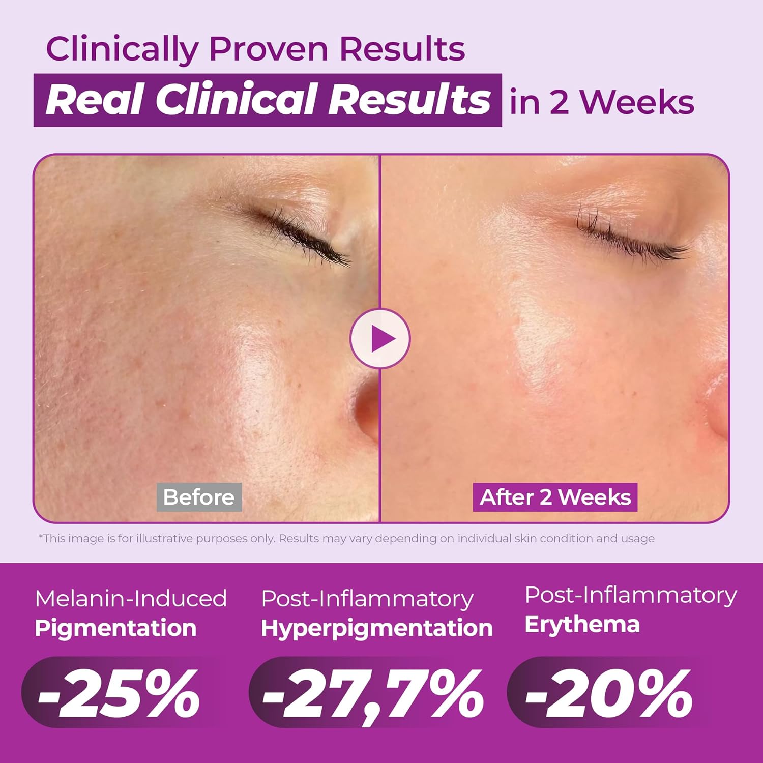 JUMISO Niacinamide 20 Serum - Korean Face Serum with Glutathione, TXA Tranexamic Acid - Reduces Pigmentation, Uneven Skin Tone, Pore Care with Centella for Sensitive Skin, 1.35 fl.oz. - Image 7