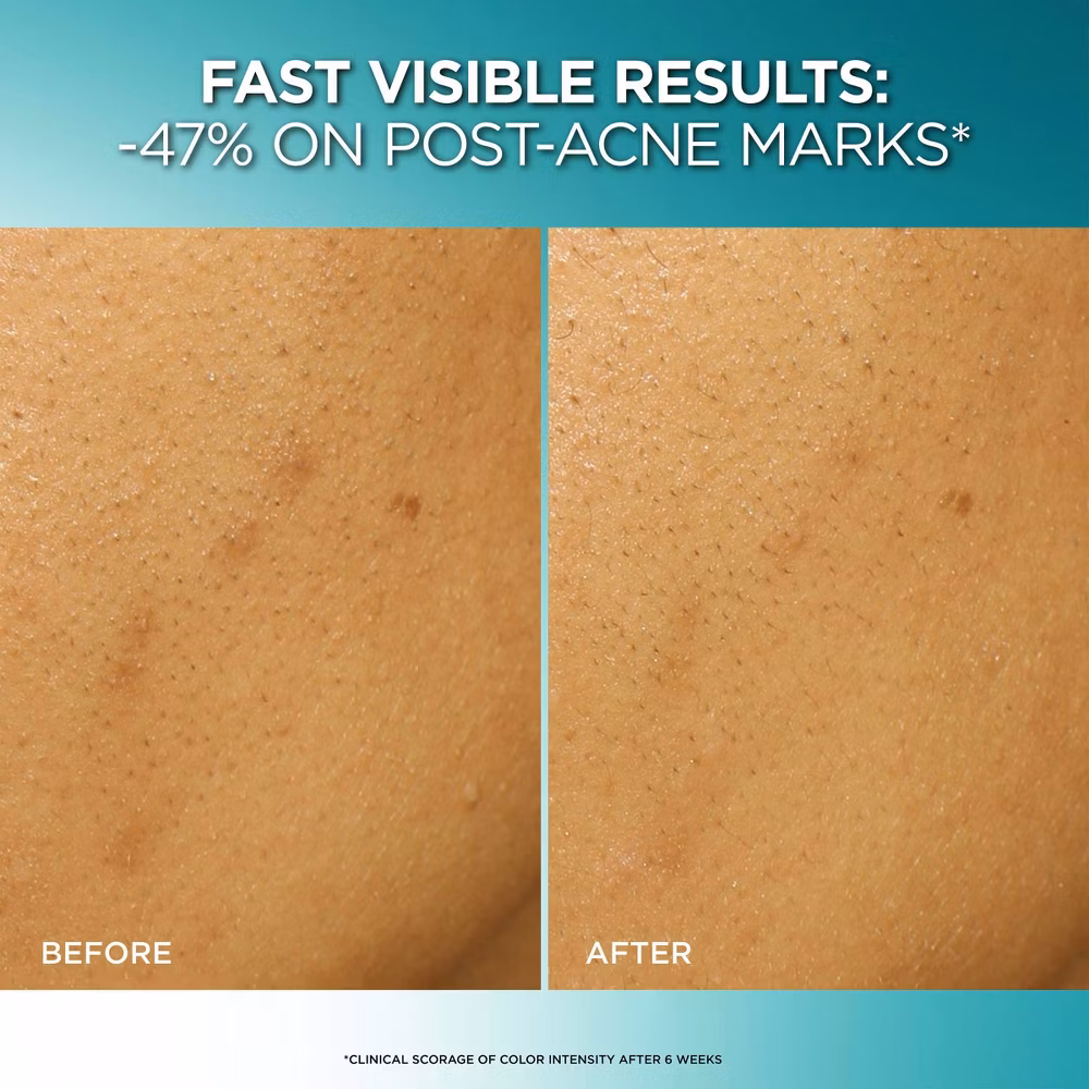 L'Oreal Paris Bright Reveal Dark Spot Exfoliant Peel - Image 8