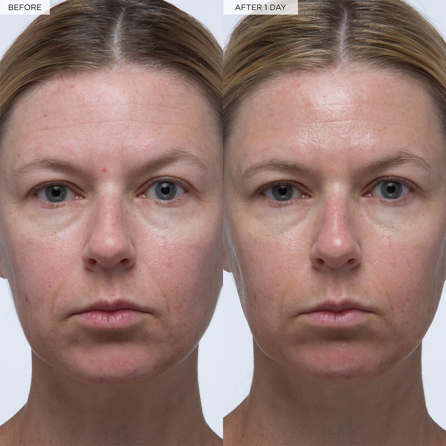 Glow Recipe Plum Plump Hyaluronic Acid Serum, Hydrating + Plumping Face Serum, Korean Serum with Vitamin B5, Barrier Support + Antioxidants, Vegan (30ml) - Image 4