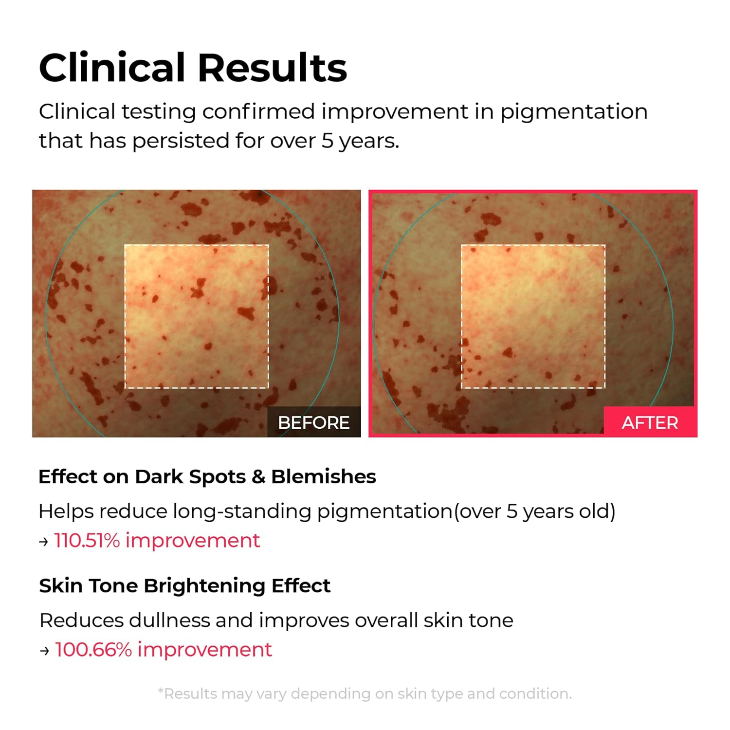 Dr Melaxin TX Astaxanthin Triple Jelly Serum – TXA, Astaxanthin & Niacinamide Face Serum for Even Skin Tone, Radiance & Hydration - Image 3