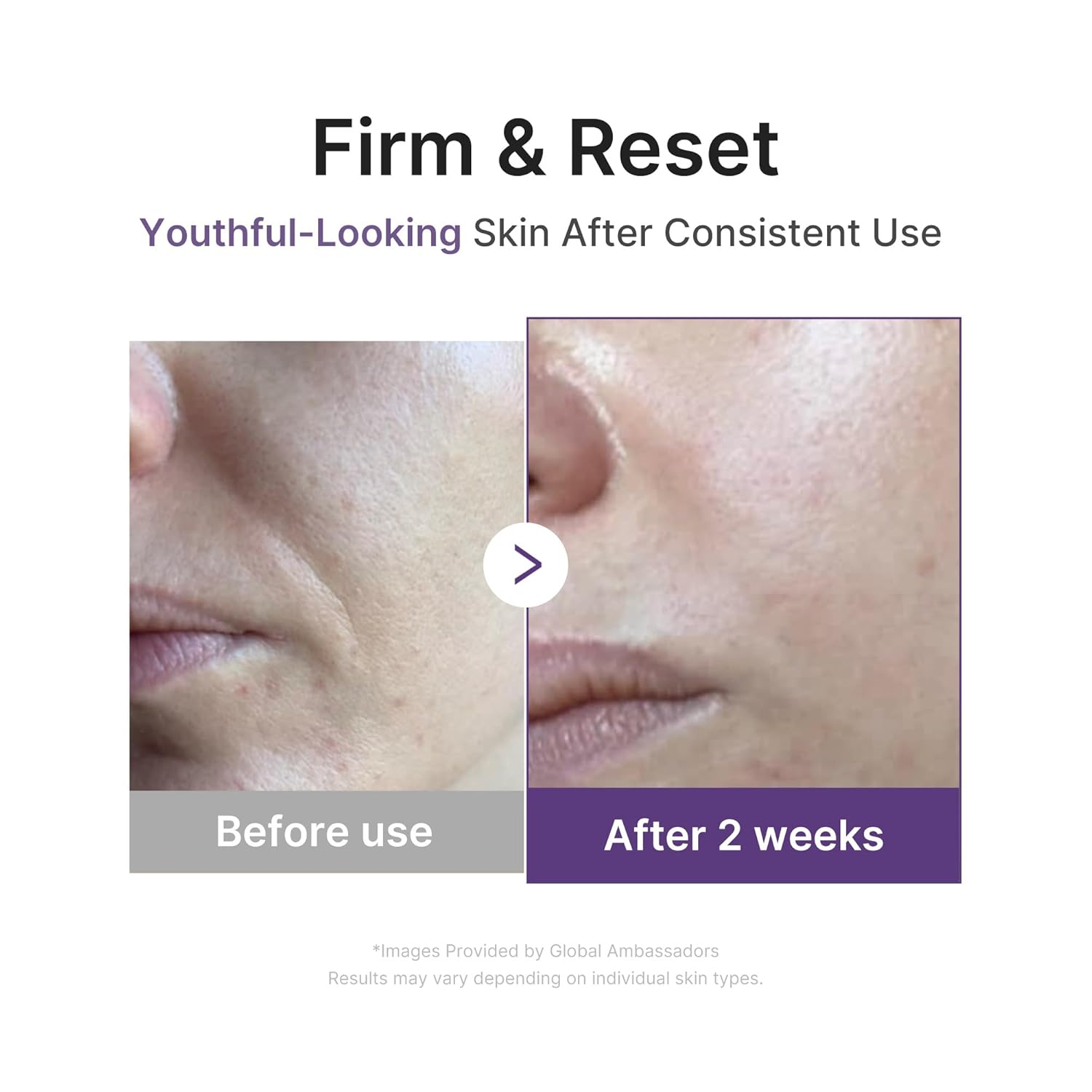 medicube Retinol Boosting Serum | Intensive Firming, Hydration & Plumping Care with Retinol, Peptides & Vitamins | Pore-Refining, Smooth Radiant Skin | Korean Skincare, 1.01 fl. oz - Image 5