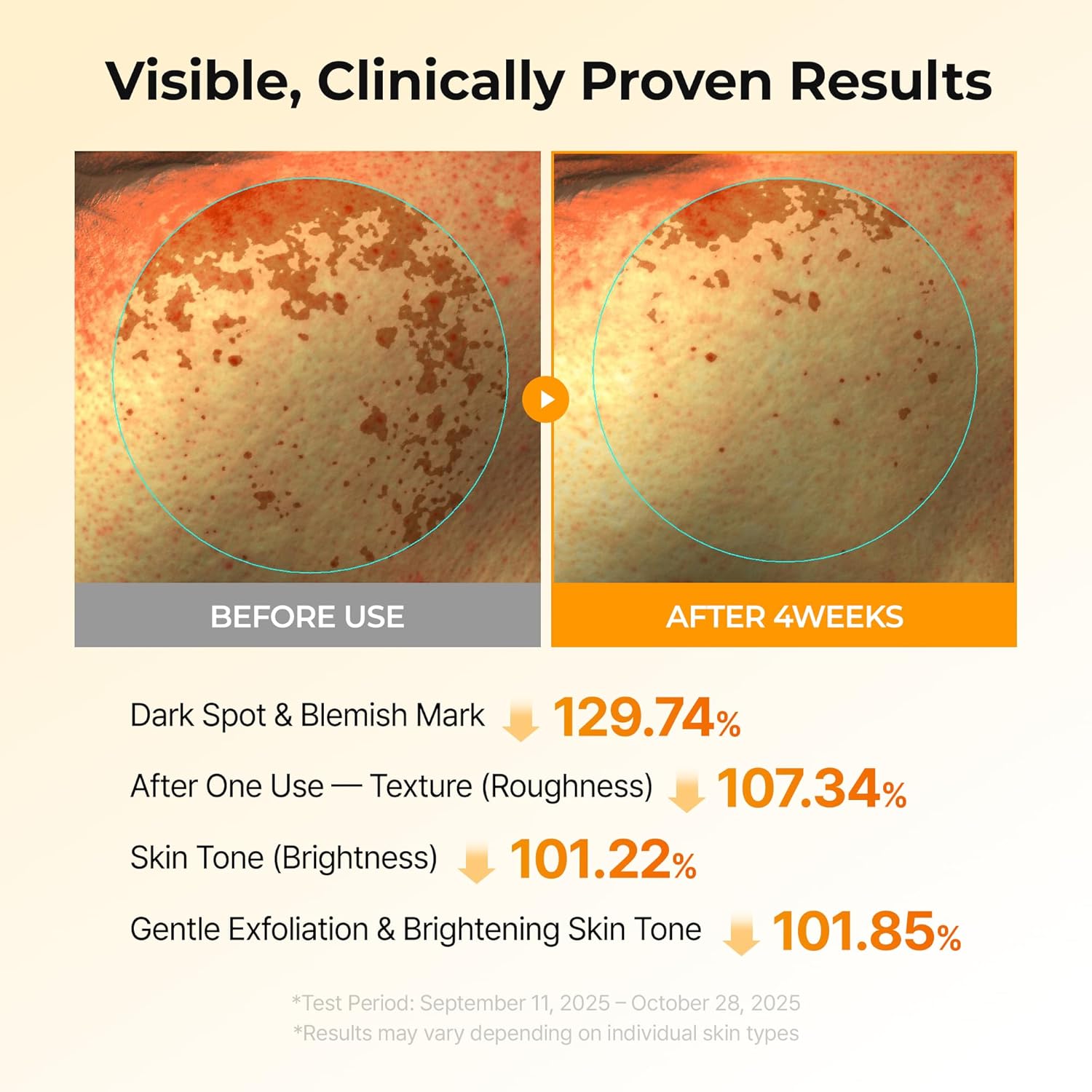 Dr.Melaxin TX Turmeric Toner Pads, 70 Sheets, Tranexamic Acid, Coic Acid, Termeric, Beautiful Skin, Brightening Toner Pad, Pigmentation, Keratin, Korean Skin Care, Korean Cosmetics - Image 4