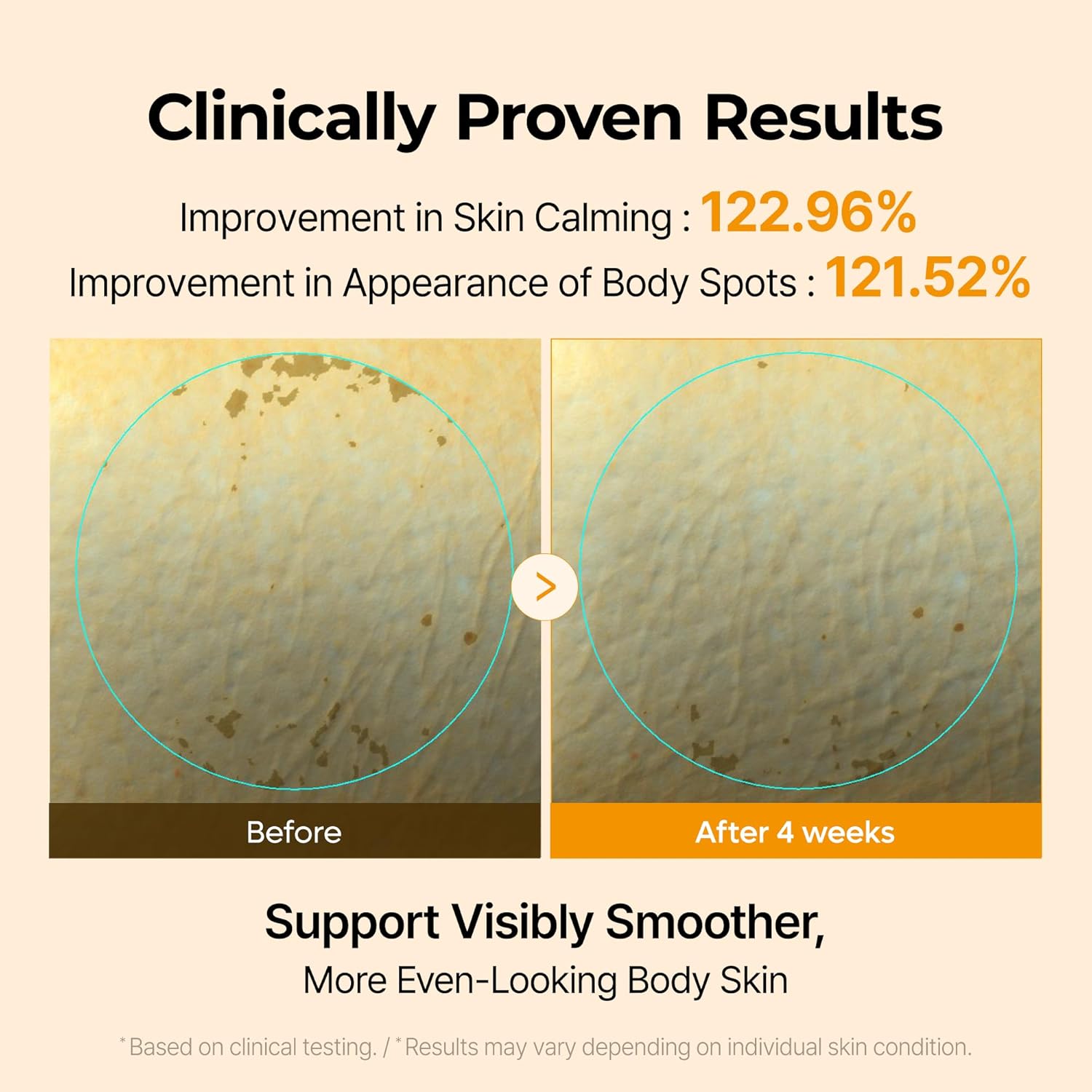 Dr Melaxin Kojic Acid Turmeric Capsule Body Cream, Brightening Body Moisturizer for Dark Spots and Uneven Skin Tone, with Ceramides & Hyaluronic Acid, 200g - Image 4