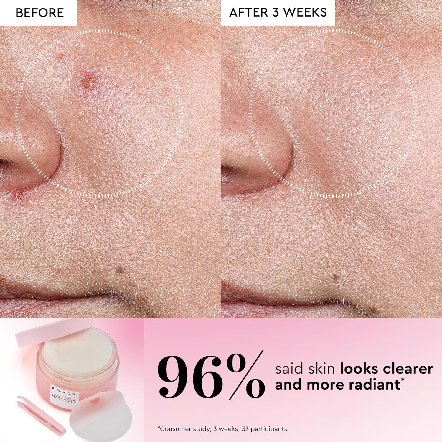 Glow Recipe LHA + AHA Toner Pads - Korean Exfoliating Toner for Face - Pore Minimizer - Hydrating Toner Pads - 5 Gentle Acids, Watermelon Enzymes, Hydrating Botanicals (60 Face Pads) - Image 5