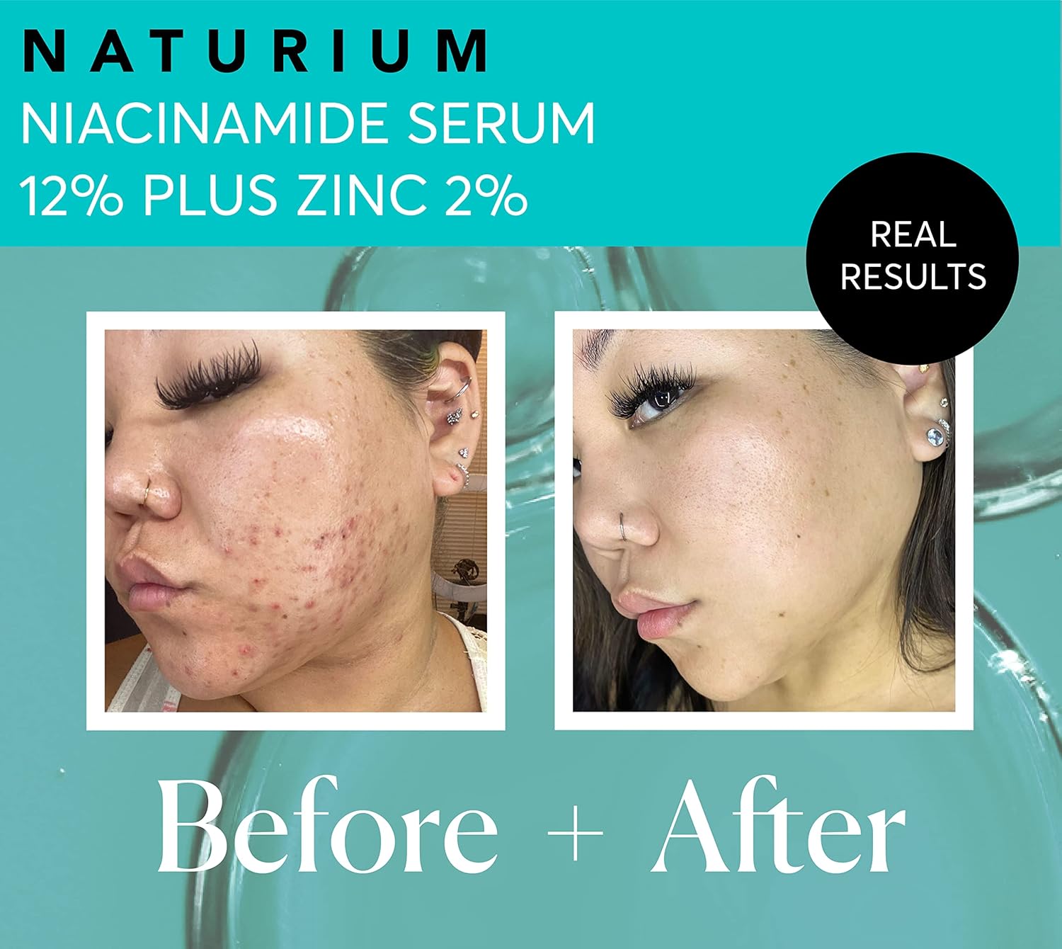 Naturium Niacinamide Face Serum 12% Plus Zinc 2%, Anti-Aging, Pore Minimizer & Dark Spot Corrector with Hyaluronic Acid & Vitamin E, Vegan & Cruelty-Free, 1 oz - Image 6