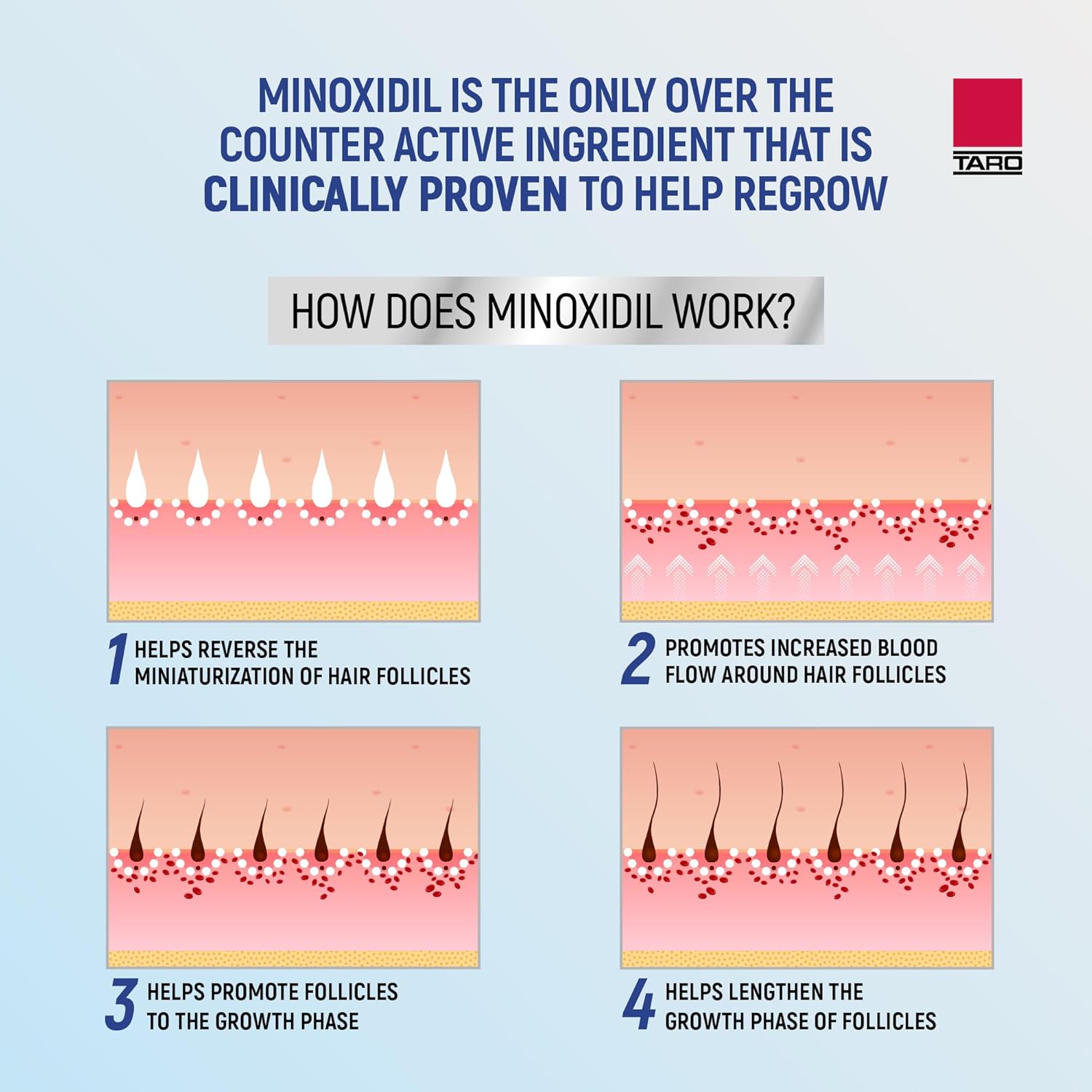 Minoxidil for Men, 2.11 Oz (1 Month Supply) Clinically Proven to Regrow Hair, Topical Aerosol Foam 5%, Hair Thinning Treatment - Image 5