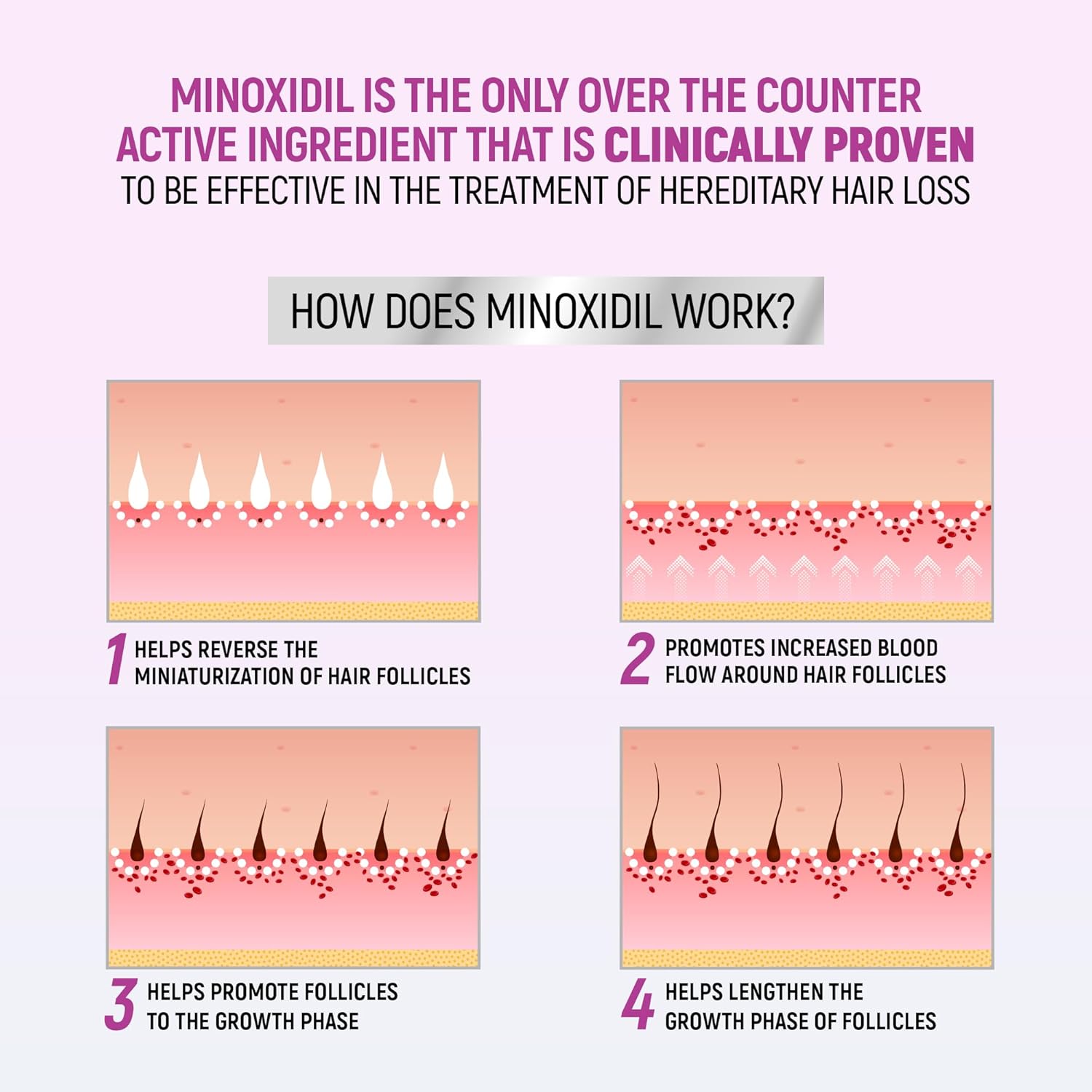 Minoxidil for Women, 2.11 Oz (2 Months Supply) Clinically Proven to Regrow Hair, Topical Aerosol Foam 5%, Hair Thinning Treatment - Image 5